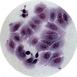実験用細胞:乳がん細胞